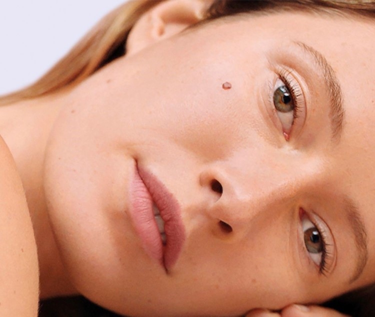 ICremas para pieles con tendencia atópica